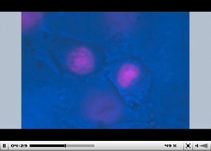 Μια ιστορία βλαστοκυττάρων - A Stem Cell Story